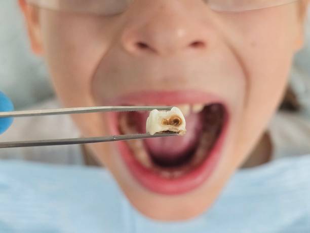 Best Emergency Pediatric Dental Care in Dahlone, GA